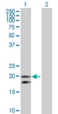 Western Blot: CEACAM21 Antibody [H00090273-D01P]