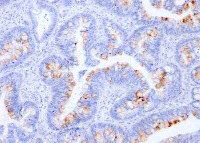 Immunohistochemistry-Paraffin: CEACAM5/CD66e Antibody (C66/1291) - Azide and BSA Free [NBP2-54429]