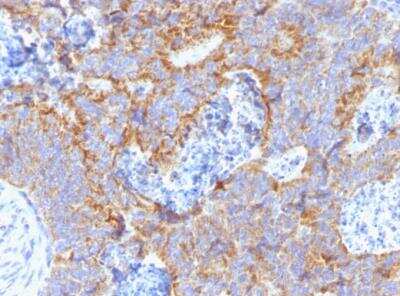 Immunohistochemistry-Paraffin: CEACAM5/CD66e Antibody (C66/1291) [NBP2-53350]