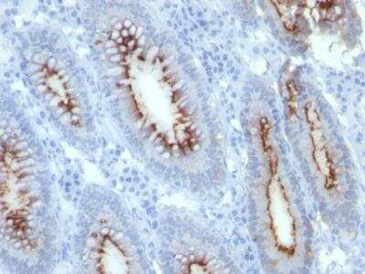 Immunohistochemistry-Paraffin: CEACAM5/CD66e Antibody (C66/261) [NBP2-33010]
