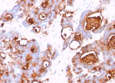 Immunohistochemistry-Paraffin: CEACAM5/CD66e Antibody (CEA31) - Azide and BSA Free [NBP2-34594]