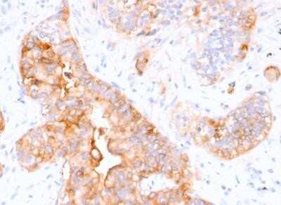 Immunohistochemistry-Paraffin: CEACAM5/CD66e Antibody (CEA31) - IHC-Prediluted [NBP2-44901]