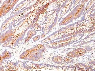 Immunohistochemistry-Paraffin: CEACAM5/CD66e Antibody (COL-1) - IHC-Prediluted [NBP3-05768]