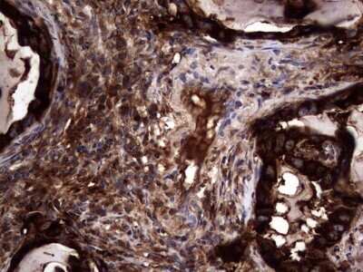 Immunohistochemistry: CEACAM5/CD66e Antibody (OTI3D8) - Azide and BSA Free [NBP2-70407]