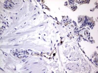 Immunohistochemistry: CEACAM5/CD66e Antibody (OTI3D8) - Azide and BSA Free [NBP2-70407]
