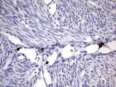 Immunohistochemistry: CEACAM5/CD66e Antibody (OTI3D8) - Azide and BSA Free [NBP2-70407]