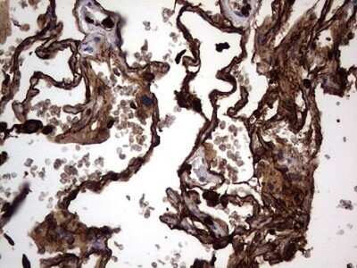 Immunohistochemistry: CEACAM5/CD66e Antibody (OTI3D8) - Azide and BSA Free [NBP2-70407]