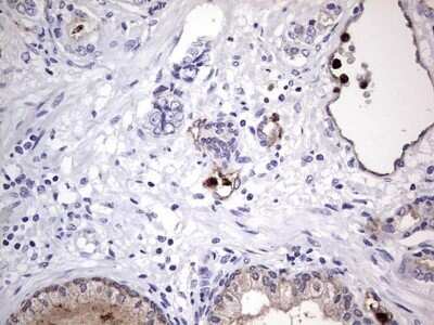 Immunohistochemistry: CEACAM5/CD66e Antibody (OTI3D8) - Azide and BSA Free [NBP2-70407]