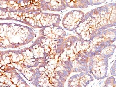 Immunohistochemistry-Paraffin: CEACAM5/CD66e Antibody (SPM541) [NBP2-33013]