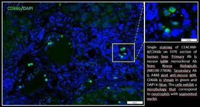 Immunohistochemistry: CEACAM8/CD66b Antibody (G10F5) [NB100-77808]