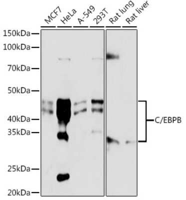 Western Blot: CEBP Beta Antibody (9W4A10) [NBP3-15761]
