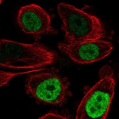 Immunocytochemistry/ Immunofluorescence: CEBP Beta Antibody [NBP2-57075]