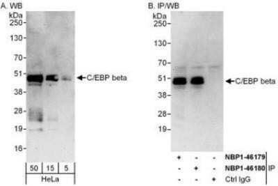 Western Blot: CEBP Beta Antibody [NBP1-46179]