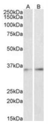 Western Blot: CEBP Beta Antibody [NBP2-26206]