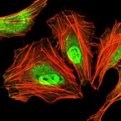 Immunocytochemistry/ Immunofluorescence: CEBP alpha Antibody (5B7) - BSA Free [NBP2-37497]