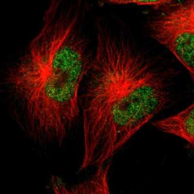 Immunocytochemistry/ Immunofluorescence: CEBP epsilon Antibody [NBP1-85446]