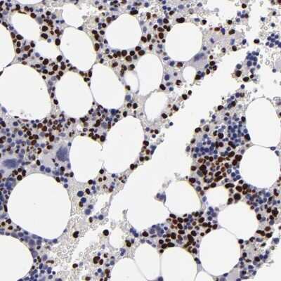 Immunohistochemistry-Paraffin: CEBP epsilon Antibody [NBP1-85446]