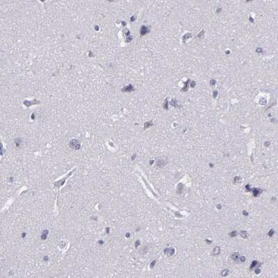 Immunohistochemistry-Paraffin: CEBP epsilon Antibody [NBP1-85446]