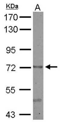 Western Blot: CEECAM1 Antibody [NBP2-15857]