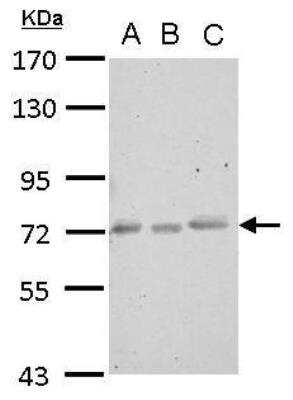 Western Blot: CEECAM1 Antibody [NBP2-15857]