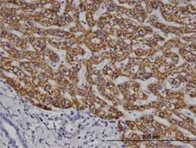Immunohistochemistry-Paraffin: CELA1 Antibody (4H5) [H00001990-M02]