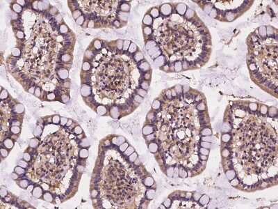 Immunohistochemistry-Paraffin: CELSR2 Antibody [NBP2-98104]