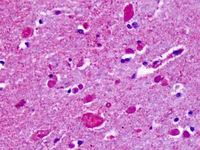 Immunohistochemistry-Paraffin: CELSR2 Antibody - BSA Free [NLS1939]