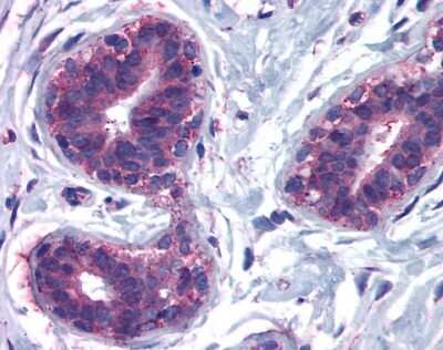 Immunohistochemistry-Paraffin: CELSR2 Antibody - BSA Free [NLS1940]