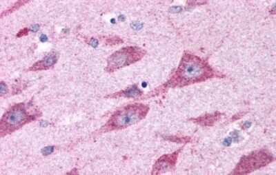 Immunohistochemistry-Paraffin: CELSR2 Antibody - BSA Free [NLS1940]