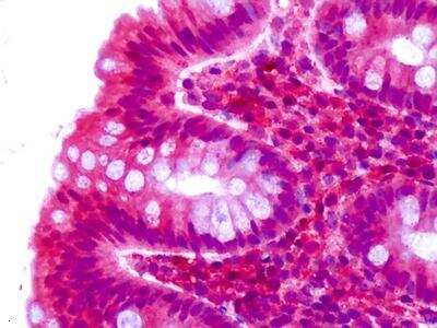 Immunohistochemistry-Paraffin: CELSR2 Antibody - BSA Free [NLS1943]