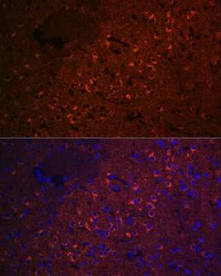 Immunocytochemistry/ Immunofluorescence: CEND1 Antibody (1D3Z1) [NBP3-16614]
