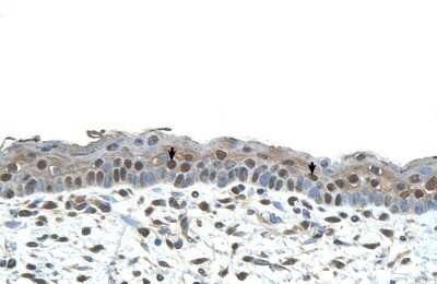 Immunohistochemistry-Paraffin: CENPA Antibody [NBP1-52937]