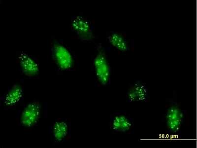 Immunocytochemistry/ Immunofluorescence: CENPB Antibody [H00001059-B01P]