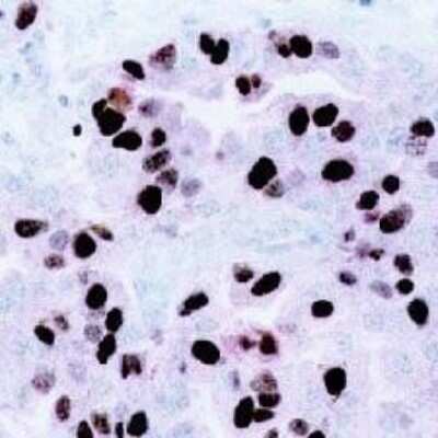 Immunohistochemistry: CENPF Antibody (7F11.2) [NBP3-13730]