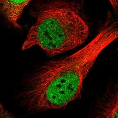 Immunocytochemistry/ Immunofluorescence: CENPF Antibody [NBP2-56124]