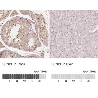 Immunohistochemistry-Paraffin: CENPF Antibody [NBP2-62641]