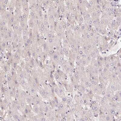 Immunohistochemistry-Paraffin: CENPF Antibody [NBP2-62641]