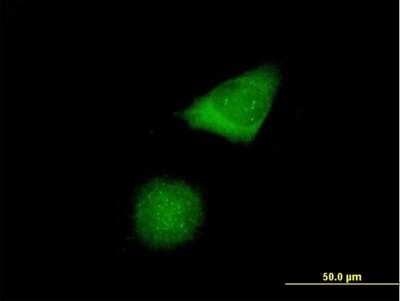 Immunocytochemistry/ Immunofluorescence: CENPH Antibody [H00064946-B01P]