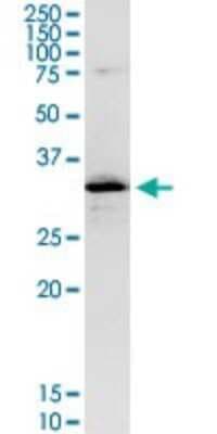 Western Blot: CENPH Antibody [H00064946-D01P]