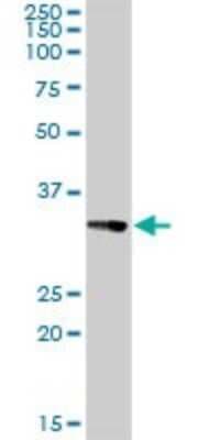 Western Blot: CENPH Antibody [H00064946-D01P]