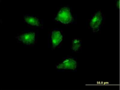Immunocytochemistry/ Immunofluorescence: CENPI Antibody [H00002491-B01P]