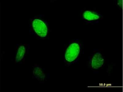 Immunocytochemistry/ Immunofluorescence: CENPJ Antibody [H00055835-B01P]