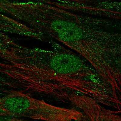 Immunocytochemistry/ Immunofluorescence: CENPJ Antibody [NBP2-57029]