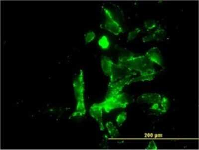 Immunocytochemistry/ Immunofluorescence: CENPK Antibody (1G2-1B10) [H00064105-M01]