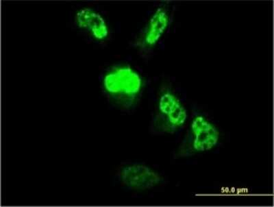 Immunocytochemistry/ Immunofluorescence: CENPM Antibody (4C12-2C8) [H00079019-M01]