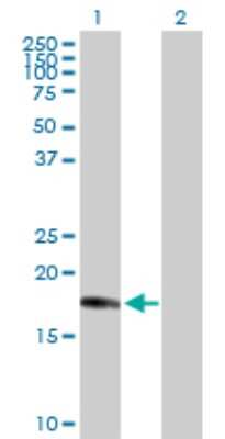 Western Blot: CENPM Antibody [H00079019-D01P]