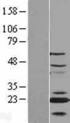 Western Blot: CENPN Overexpression Lysate [NBL1-09089]