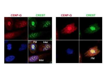 Immunocytochemistry/ Immunofluorescence: CENPQ Antibody [NBP1-42740]