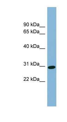 Western Blot: CENPQ Antibody [NBP1-55216]