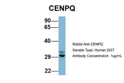 Western Blot: CENPQ Antibody [NBP1-55216]